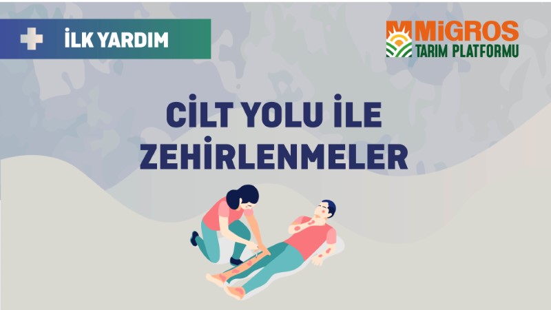 2- Cilt Yoluyla Zehirlenme